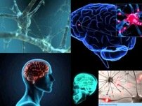 Personal Injury Assessments Psychologists